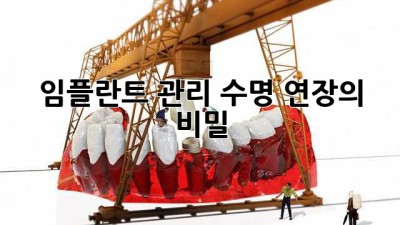 임플란트 관리: 수명 연장의 비밀